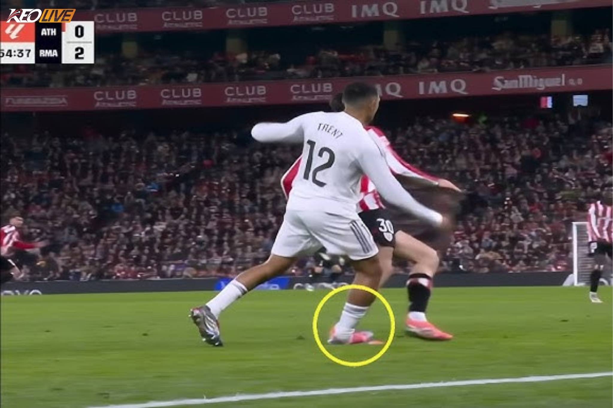 Tình huống dẫn đến chấn thương của Trent | Keolive