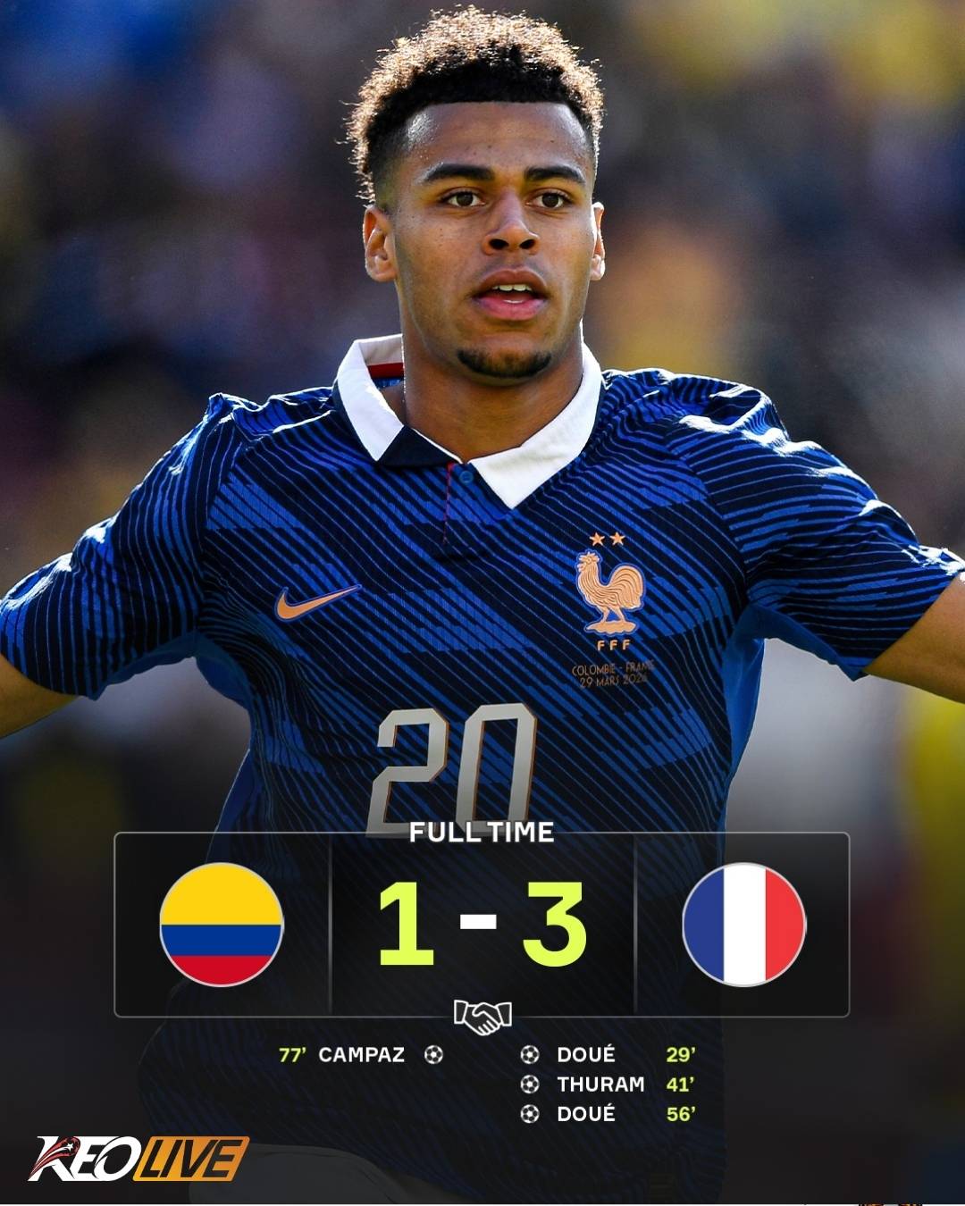 Colombia 1-3 Pháp | Keolive